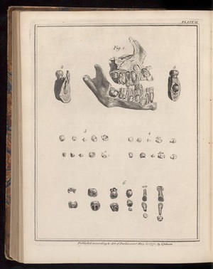 view Plate IX, The natural history of the human teeth.