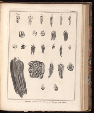 view Plate XIV, The natural history of the human teeth.