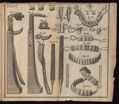 Dental instruments used for creating artificial teeth. 18th century.