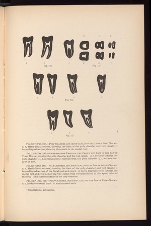 view Cross section of the pulp chamber and root canals of the molars. 