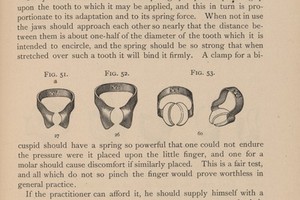 view Tooth clamps used during dental fillings. 