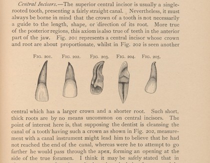 Illustration of teeth and roots, and cross sections. 