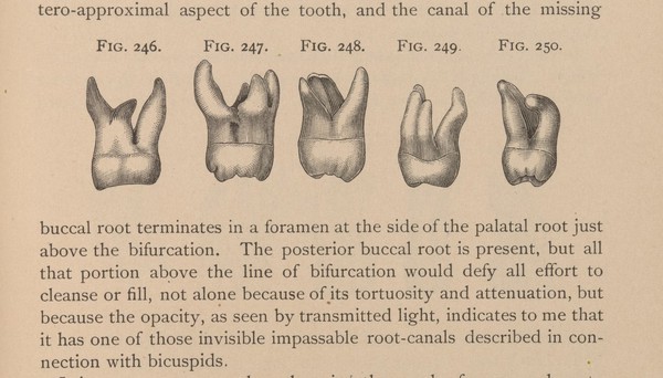 Illustration of molar teeth and roots. 