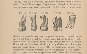 view Illustration of molar teeth and roots. 