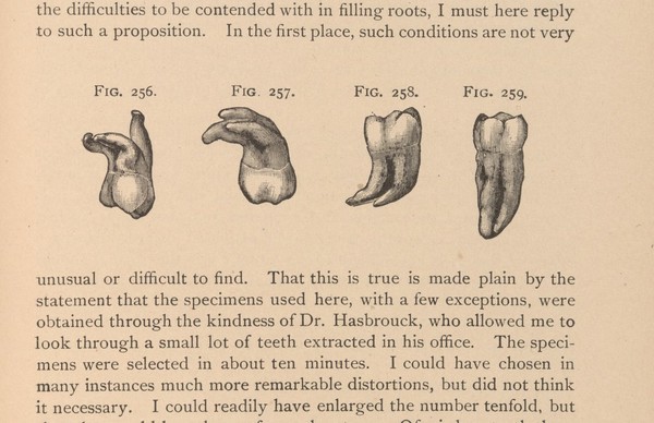 Illustration of teeth and roots. 