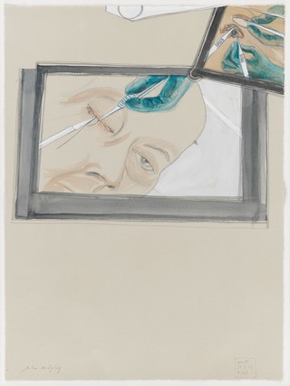 Sewing up of an eye cavity in a cadaver after removal of the eye for training of surgeons. Watercolour by Julia Midgley, 2013.