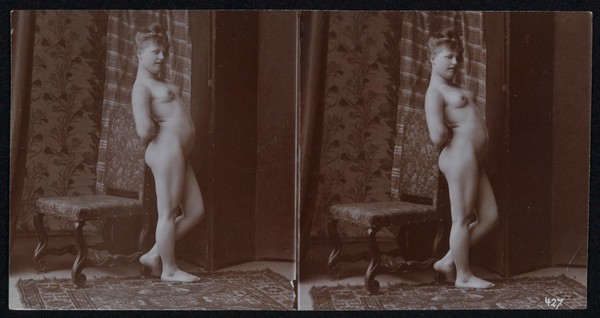 A young woman posing naked in a photographic studio, leaning on the back of a chair, in front of a screen. Stereo photograph, ca.1900.