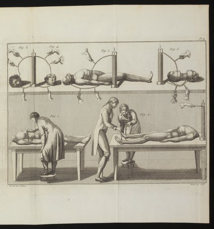 Essai theórique et expeŕimental sur le galvanisme, avec une seŕie d'expeŕiences faites en preśence des Commissaires de l'Institut national de France, et en divers amphitheátres anatomiques de Londres / par Jean Aldini.