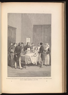 Doctor Jules Cloquet performs a painless operation on a woman in magnetic sleep.