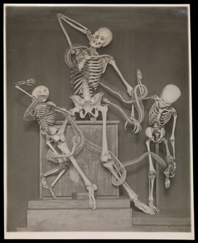 Three human skeletons displayed with a snake skeleton, representing Laocoön and his sons. Photograph, ca. 1929.