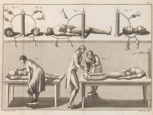 Galvanism experiments on human body parts