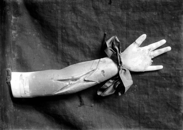 Wax voto of arm and hand with bow at wrist. Musee Etnographiquo, Palmero.