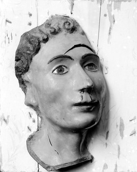 Wax ex-voto of head. Gash in forehead and blood from nose. Musee Etnographique, Palermo.