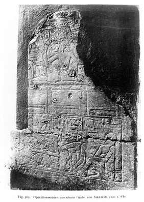 Egyptology, Illustration from, Plastik und medizin
