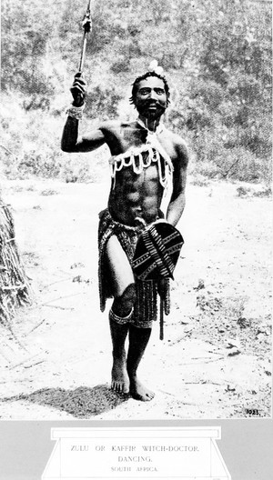 view Zulu witch doctor dancing, South Africa. Tying cure in which the tie around the chest of a man suffering from pleurisy etc.