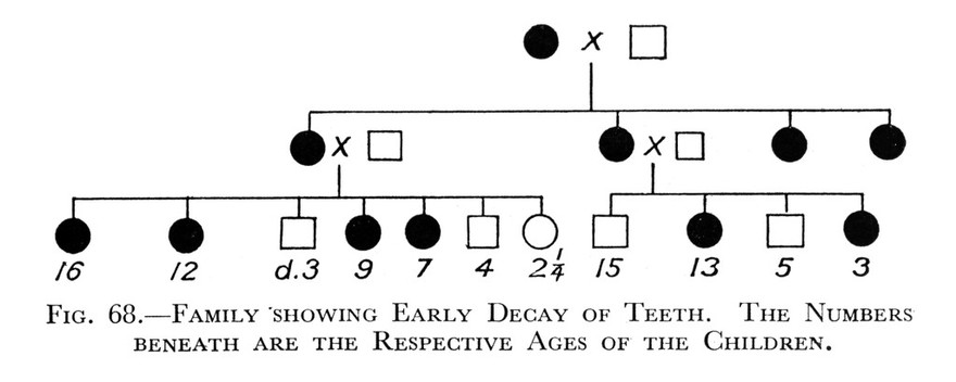 Charts, family showing early decay of teeth. Pedigree of Haemophilia (after Davidson and Mc. Quarrie).