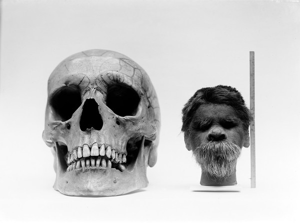 Shrunken head compared with normal human skull.