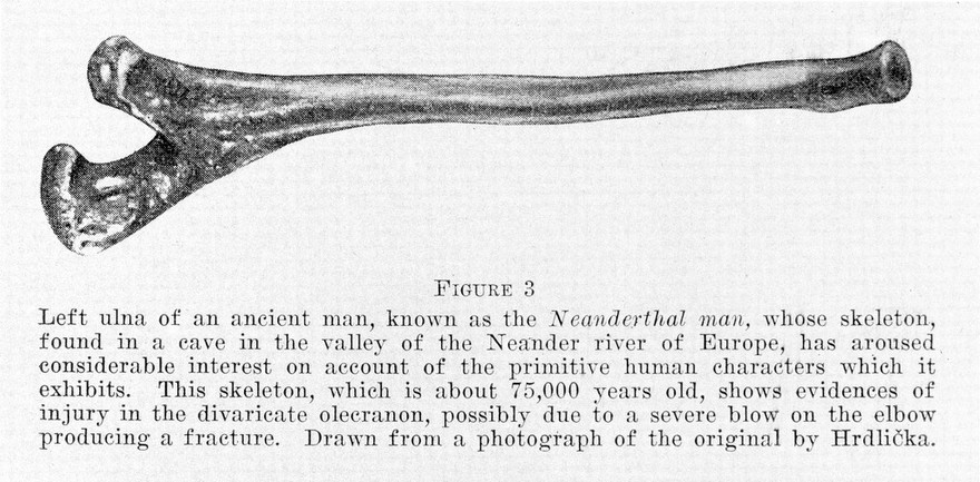 Left ulna of the Neanderthal Man