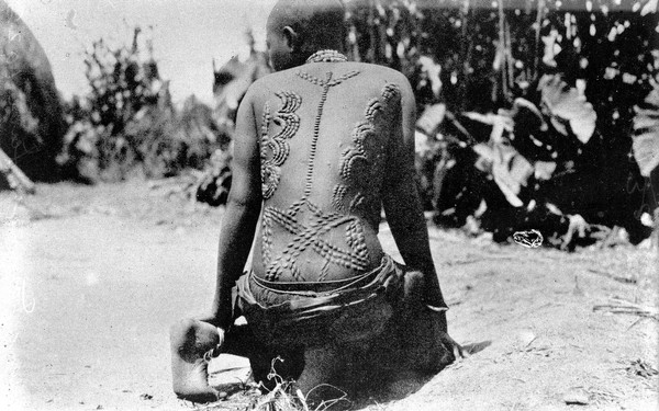 African showing cicatrization on the back.