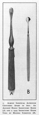 Ancient Hindu iridectomy knives, one used by modern surgeons