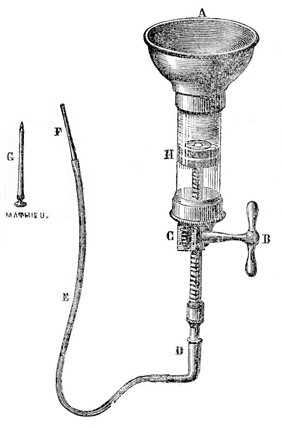 Transfusion apparatus, 19th century.