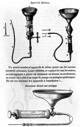 M0005170: Noel's apparatus for direct blood transfusion, 1876