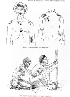 M0005575: Illustrations with the caption "Tattoo designs used in medicine"