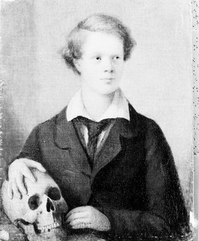 M0005604: Portrait of Robert Liston (1794-1847)