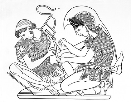 Wounded soldier being bandaged. From a Greek vase.