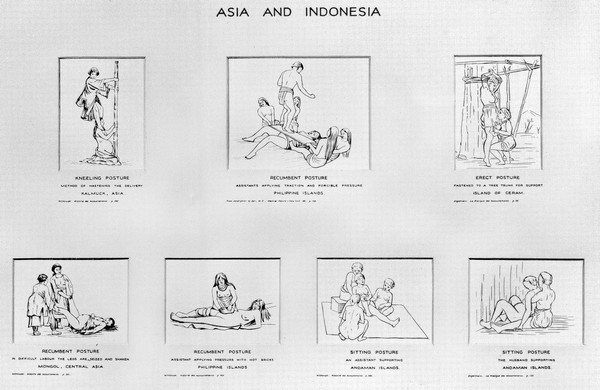 M0006387: Wellcome Historical Medical Museum display: drawings of birth postures from Asia and Indonesia