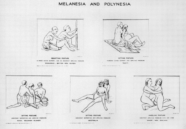 Drawings of birth postures, 5 subjects, Melanesia, Polynesia