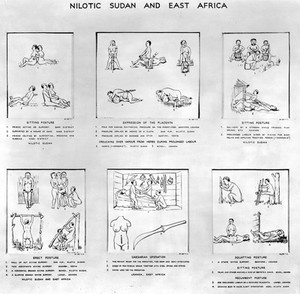 view Drawings of birth postures, 6 subjects, Nilotic Sudan