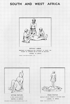 M0006391: Wellcome Historical Medical Museum display: drawings of birth postures from South and West Africa