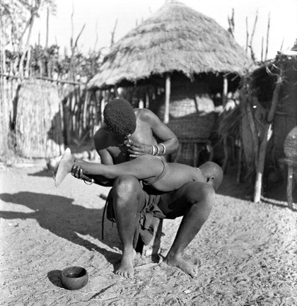 M0006587: Kwanyama woman giving an enema to a boy / M0006587EA: Kwanyama woman giving an enema to a boy / M0006587EB: Kwanyama woman giving an enema to a boy / M0006588: Kwanyama woman giving an enema to a boy