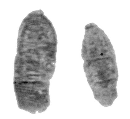 M0007022: Photograph of two leeches, possibly photographed under microscope