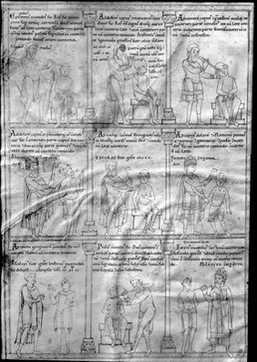 M0007090: Manuscript illustrations of surgical operations