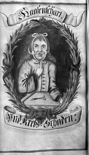 view Harelip and cancer damage, 16th Century