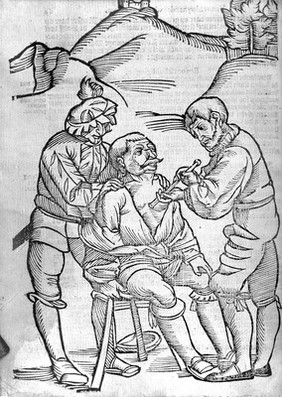 M0007322: Illustration of a surgeon cauterising a wound