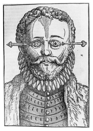 M0007416: Illustration of a man with cataract symptoms from <i>Ophthalmodouleia</i>