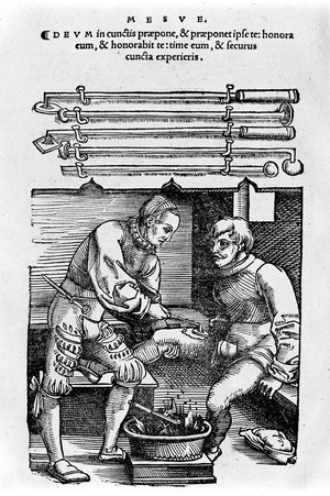 view Cauterization and instruments, illustration, 16th century.