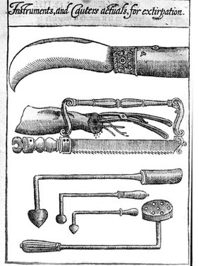 M0008085: Amputation instruments, from Lowe: <i>A discourse of the whole art of chyrurgerie</i>