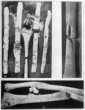 M0008138: Primitive splints, from Moodie: <i>Paleopathology</i> (1923)