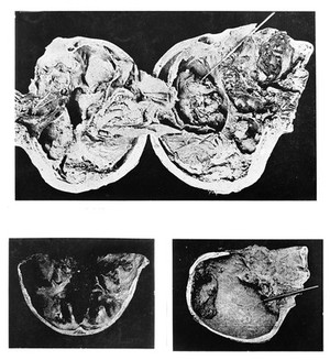 view Illustrations of processes of mummification