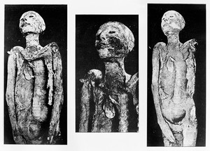 view Illustrations of processes of mummification