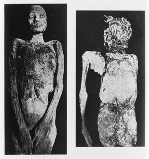 view Illustrations of processes of mummification