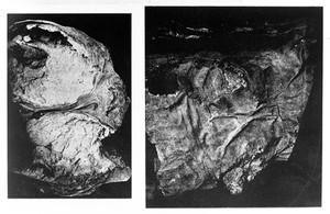 view Illustrations of processes of mummification