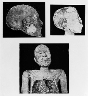 view Illustrations of processes of mummification