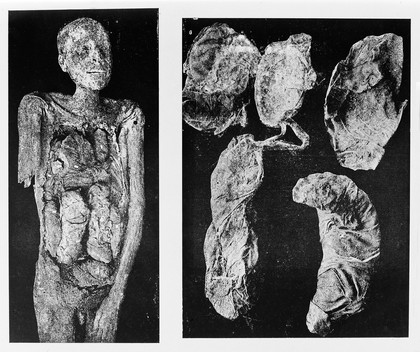 Illustrations of processes of mummification