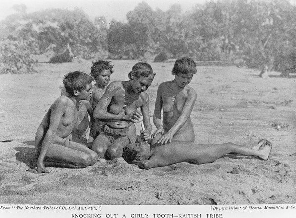 Knocking out a girl's tooth, Kaitish people, Australia.