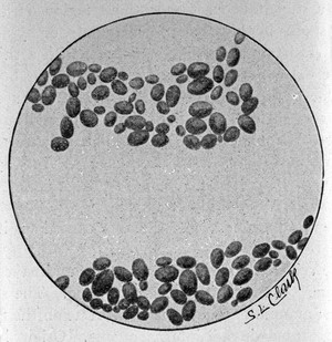 view Yeast cells. Saccharomyces cerevisiae (Coplin).